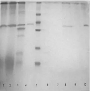 Figure 4 - SDS-PAGE  with Coomassie staining of the  purification steps of W. anomalus PG