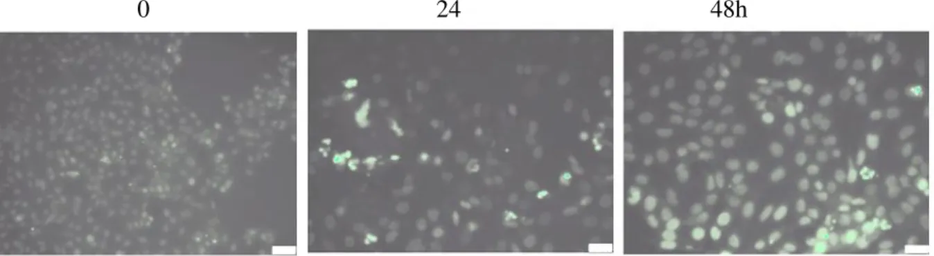 Figure 2 - Effects of AHLE on TUNEL assay at 0, 24, 48 h. 