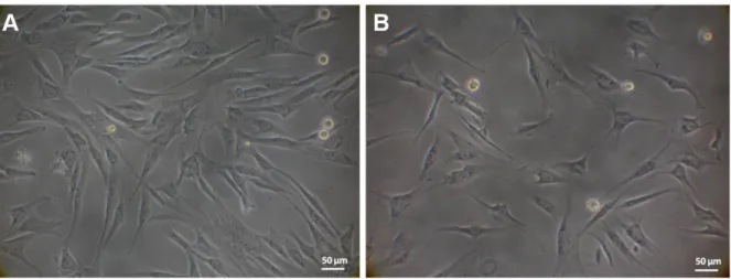 Figure 3. 1 – Representative light microscopy images of cASCs obtained by enzymatic digestion from  different  anatomical  sites,  namely  subcutaneous  (A)  and  omental  (B),  after  48h  of  culturing  in  basal  medium