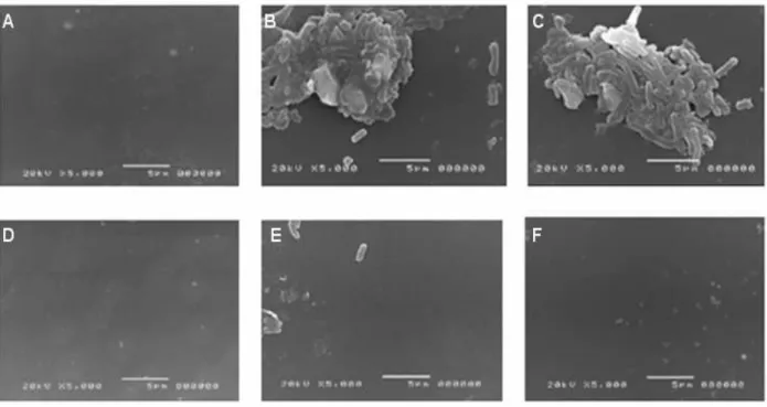 Figure 1 - SEM images showing the effect of  xylitol on the adhesion of E. coli  ATCC 8739