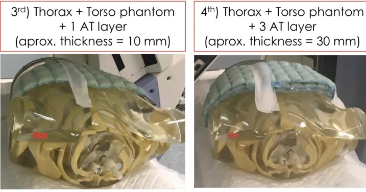 Fig. 3: Thorax phantom.  Fig. 4: Thorax and torso  phantoms. 