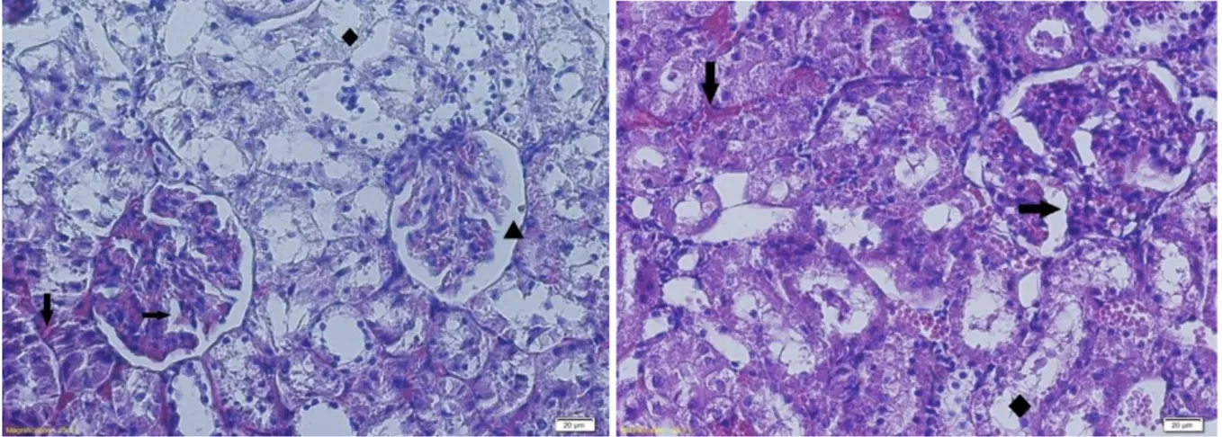 Figure  7-  Kidney  sections  of  Diabetic  control rats  X200,  H&amp;E.  glomerular  lobulation  (→),  hemorrhage  (↓),  Dilatation of Bowmann’s space (▲), Tubular degeneration (♦)