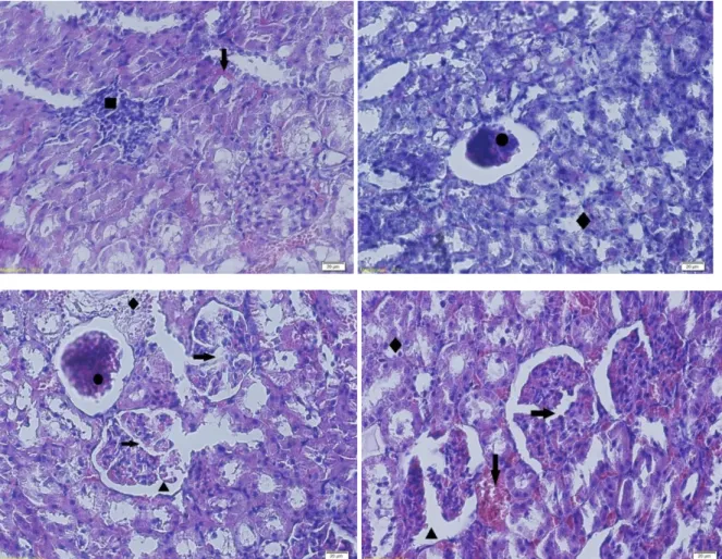 Figure  9-  Kidney  sections  of  Diabetic  furan  rats X200,  H&amp;E.  hemorrhage  (↓),  inflammatory  cell infiltration  (▀),  Tubular  degeneration  (♦),  glomerular  atrophy  (●),  glomerular  lobulation  (→),  Dilatation  of  Bowmann’s  space (▲)
