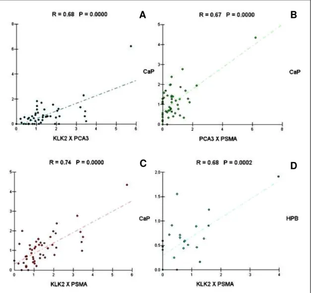 Figura  5.  Representação  gráfica  para  as  correlações  de  Pearson  positivas  encontradas  para as expressões dos biomarcadores KLK2, PSMA e PCA3 no câncer de próstata (CaP)  e na hiperplasia prostática benigna (HPB)