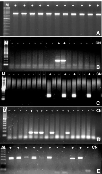 Figura 1. Representação da RT-PCR Nested  qualitativa dos  genes  PCA3,  PSMA,  KLK3  e  KLK2  realizado  no  sangue  periférico  de  voluntários  saudáveis,  pacientes  com  hiperplasia benigna e com câncer de próstata