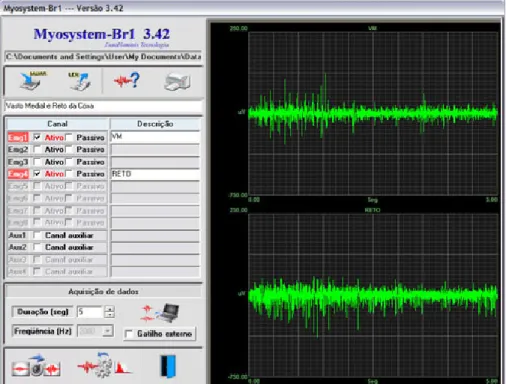 Figura 2.16 – Software de aquisição, processamento e análise de dados que  acompanha o eletromiógrafo da Datahominis Tecnologia LTDA