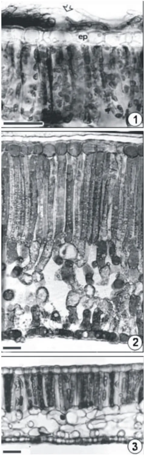 Figure 1. Transverse sections of S. macrophylla leaf. 1) detail of shade leaf with sooty mold