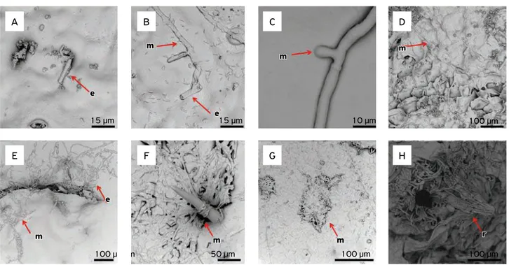 Figure 4. Isolate from passionflower at 2, 4, 6, 12, 24, 48, 72 and 96 hours (A, B, C, D, E, F, G and H, respectively) post-inoculation in fruits.