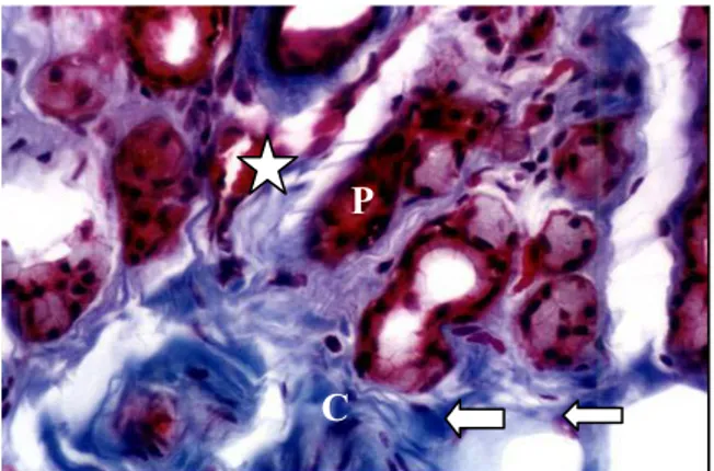 Figure 4. Photomicrography of third eyelid gland of  dog with canine distemper. Observe  intratubular  polimorphonuclears (arrow) and partial or total  obstruction of the tubuloacinar glands (stars)