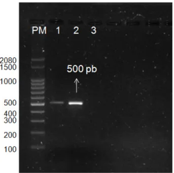 Figura 5: Detecção do DNA de Mycobacterium bovis por PCR direto de swab nasal  de  bovinos  positivos  no  teste  cervical  comparativo  para  tuberculose