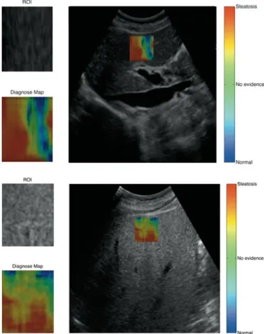 Fig. 6. Correct classified HS US samples with the proposed CAD system interface.