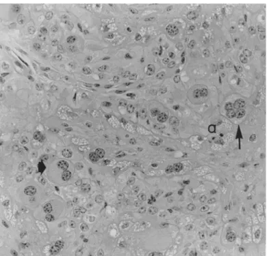 Figure 3. Synepitheliochorial placenta in zebu cow with normal non-induced delivery: migration of  binucleate cells into the maternal epithelium (large arrow) forming a fetal-maternal hybrid with  multinucleate cells (arrow); apoptotic body in the maternal