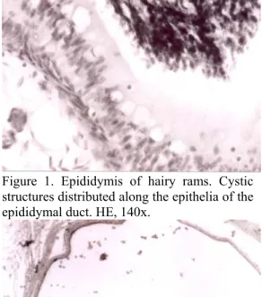 Figure 2. Epididymis of hairy rams. Cyst  structure reached considerable development. HE,  140x