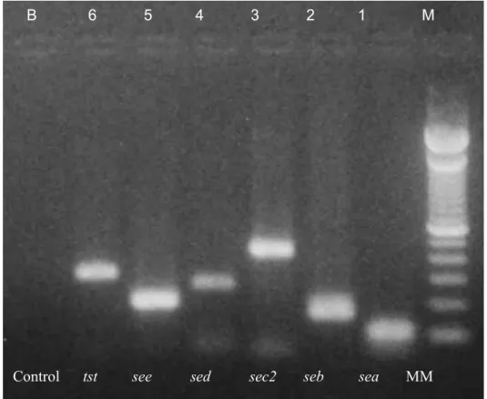 Figure 3. Electrophoresis of the PCR fragments generated using DNA extracted with method 1(without  lysostaphin) and primers sets specific for the enterotoxins genes