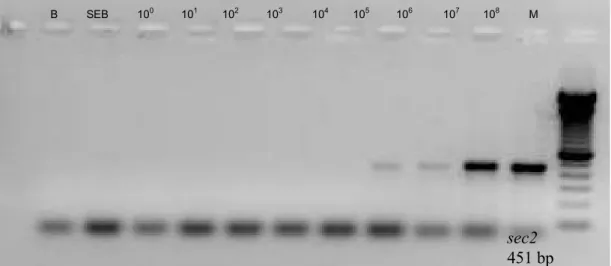 Figure 4. PCR using DNA extracted by method 1 (with lysostaphin) and various quantities of S