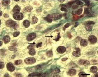 Figure  1.  Transplanted  canine  venereal  tumor  during  the  growing  phase.  Observe  the  mitosis  figures  (arrows) (Schorr, bar = 10m)