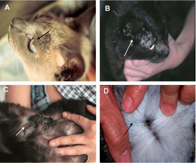 Figure 1. A- Hyperkeratotic and hyperchromatic plaque on the left preauricular area (case1) (arrow)