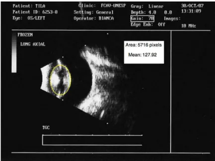Figure 1. Dog. Ultrasonographic image showing the lens selected as a region of interest (yellow circle)  for echogenicity analysis and echogenic index
