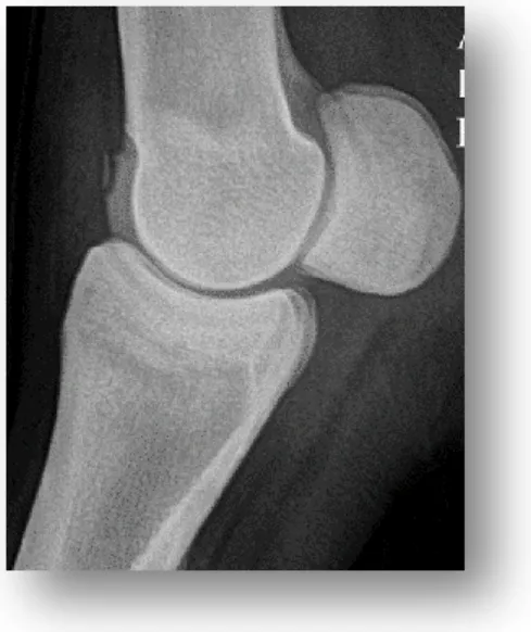 Figura 1: Radiografia LM de um boleto com lesão osteocondral na crista sagital do metacarpo  (imagem gentilmente cedida pela Prof