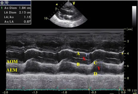 Figura 1. Cão. Representação esquemática dos pontos de referência utilizados no Modo-M (AOM: aorta  no modo-M; AEM: átrio esquerdo no modo-M; linha X: distância entre A-B (AOM); linha Y: distância  entre C-D (AEM); pontos de referência: A,B,C,D)