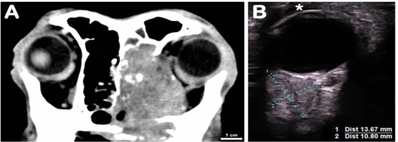 Figure 2. Dog. (A) Axial computed tomography scan image showing the extensive tumor involvement of  the frontal sinuses, bony orbit, orbital cavity, pterygopalatine fossa, nasopharynx, and oral cavity on the  right side