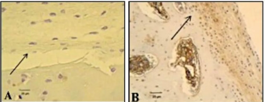 Figure  3.  Immunohistochemical  evaluation  after  90  days  post-operation,  stained  with  ultra  streptavidin  peroxidase on the repair tissue deposited in the defects produced in the stifles of rabbits