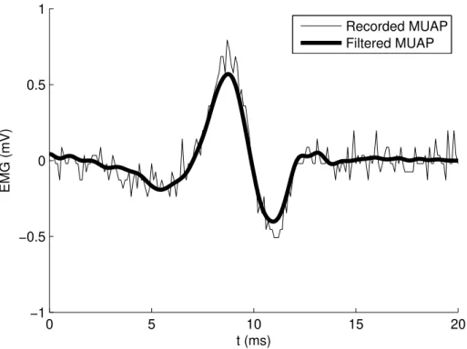Figure 2.4: Actual motor unit action potential recorded by the equipment used in this study