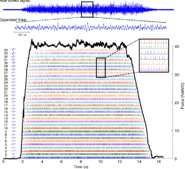 Figure 2.6: EMG decomposition. The level of contraction rises from rest up to 40%