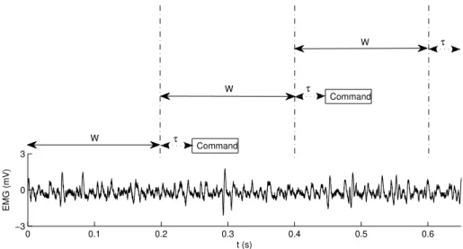 Figure 3.3: EMG signal with 200 ms adjacent epochs. The signal was sampled at 10 kHz which is the rate the signal processing unit must work (10 thousand values per second).