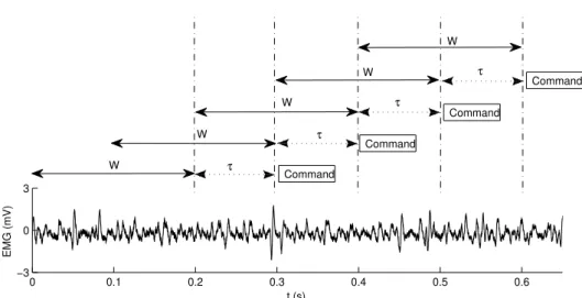 Figure 3.4: EMG signal with 200 ms overlapping epochs and 100 ms increment time (50% overlap)