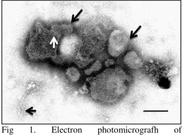 Fig  1.  Electron  photomicrografh  of  Paramixovirus  particles  in  intestinal  contents  of  the  bullfrog  (L