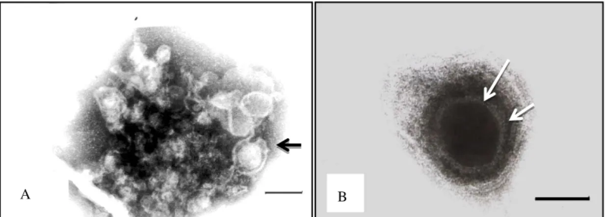 Fig.  2.  A  -  Electron  photomicrografh  of  Herpesvirus  particles  in  intestinal  contents  of  the  bullfrog  (L