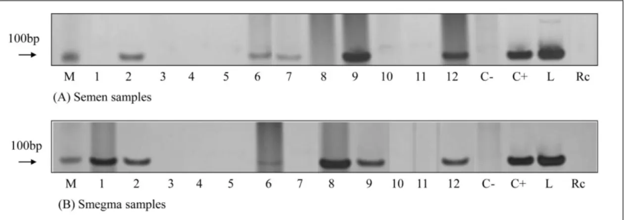 Figure 1. Detection of Leishmania infantum DNA in semen (A) and smegma (B) samples of infected dogs  (1 to 12)