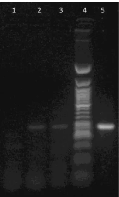 Figure 1. RT-nested-PCR for the detection of a fragment of the ORF2 gene of hepatitis E virus, showing  negative  control  (lane  1),  a  pooled  fecal  sample  (7A,  lane  2),  slurry  sample  (7B,  lane  3)  M  is  100  bp  molecular weight marker (lane 