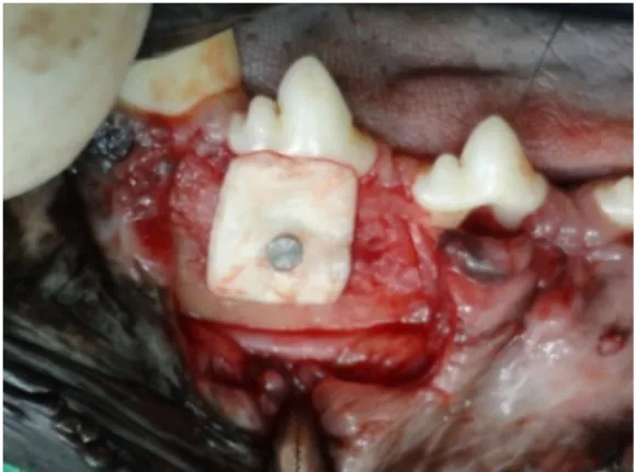 Figure  1.  Hydroxyapatite  (HA)  and  polycaprolactone (PCL) membrane attached by a  screw  on  the  experimentally  induced  bone  defects in the third premolar root of a dog before  repositioning  the  gingival  flap  and  suturing  for  assessing perio