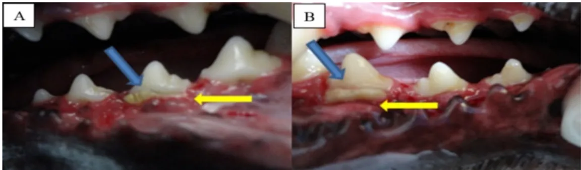 Figure 2. Membrane exposure (blue arrows) in the group treated with gingival recession (yellow arrows)  at 60 days after placing the membrane on the third (A) and fourth premolar (B) of a dog in the treatment 