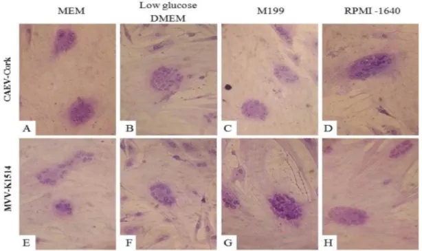Figure 5. Cytopathic effect in GSM cells. Viral titration of CAEV-Cork (A, B, C, D) and MVV-1514 (E,  F,  G,  H)  replicated  in  sheep  cells  from  WJUC  in  different  media