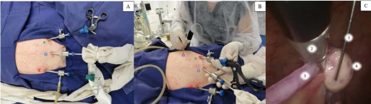 Figure  1.  Follicular  aspiration  by  laparoscopy  in  Cuniculus paca.  In  (A)  and  (B)  patient  positioning  and  external  view  of  the  arrangement  of  laparoscopic  portals  in  the  caudal-cranial  direction  with  the  animal  in  supine posit
