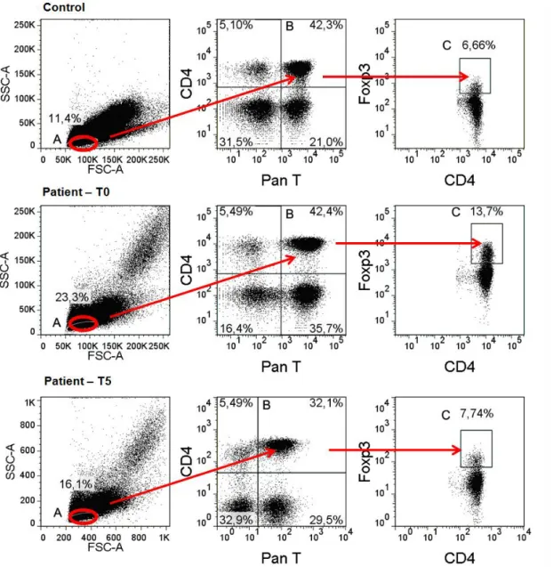 Figure 2. Representative flow chart of lymphocyte gates (A); from it the gate of CD4 + lymphocytes (B)  and, from  this, the gate of CD4 + Foxp3 + (Treg) (C) of a dog control (upper panel) and a dog with  lymphoma in M0 (patient - T0, middle panel) and M5 