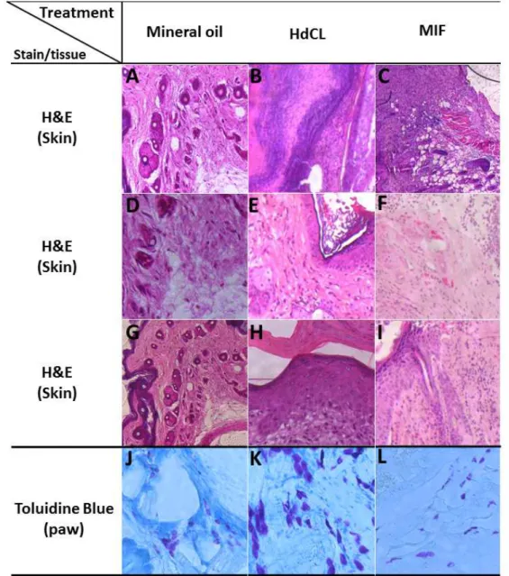 Figure 3. Effect of HdCL and MIF on histological aspects of wound healing model. 40x (A, D), 100x (B,  E, F) and 200x (C) magnification