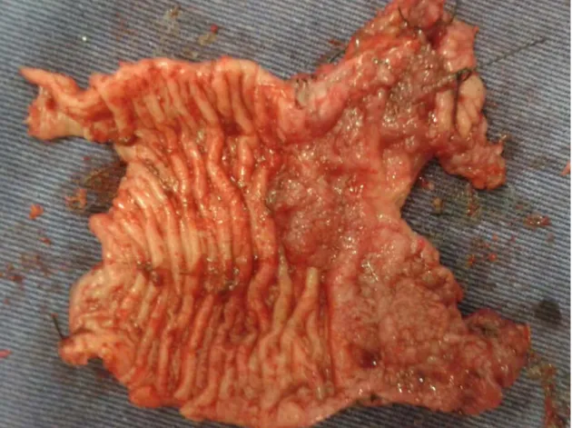 Figure 2. Photograph of the mucosal changes of the descending colon in a dog diagnosed with intestinal  intraluminal papillary adenocarcinoma