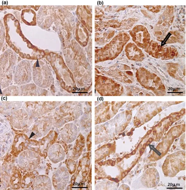 Figure 4. Photomicrography of renal cortex stained by antibody anti-E-cadherin (bar= 400 µm) after renal  ischemia and reperfusion injury in dogs, showing intracytoplasmatic protein (arrow tip) and the protein’s  relocation in the cytoplasm (open arrow)