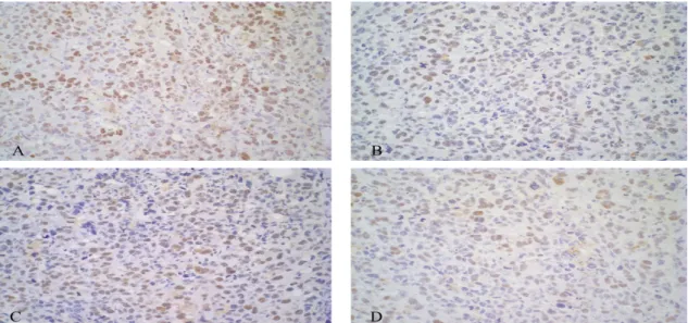 Figure 7. Photomicrography of immunohistochemistry expression of anti-cdc47 antibody of Ehrlich solid  tumor  in  Swiss  mice  for  each  group:  (A)  Control,  (B),  Bleomycin,  (C),  Electric  pulses  and,  (D)  Electrochemotherapy