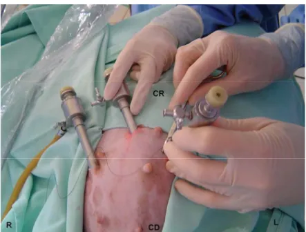 Figure 1. Triangular placement of trocars in laparoscopic cystotomy for the removal of bladder stones in dogs