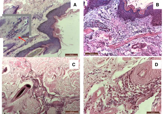 Figure  4.  Skin  histology  of  red  deer.  A)  Orthokeratotic,  eosinophilic,  mast  cells  and  lymphocytic  infiltration of the dermis