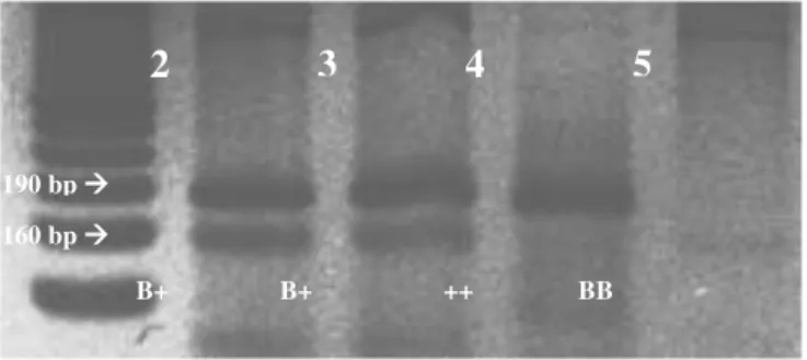 Figure 1. PCR products digested with Ava  II. 1: DNA ladder 50 bp; 2: Santa Inês heterozygote (B+); 4: 