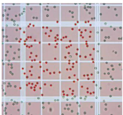 Figure  4.  Red  marks  identify  the  cells  counted  with the computer-aided counting software