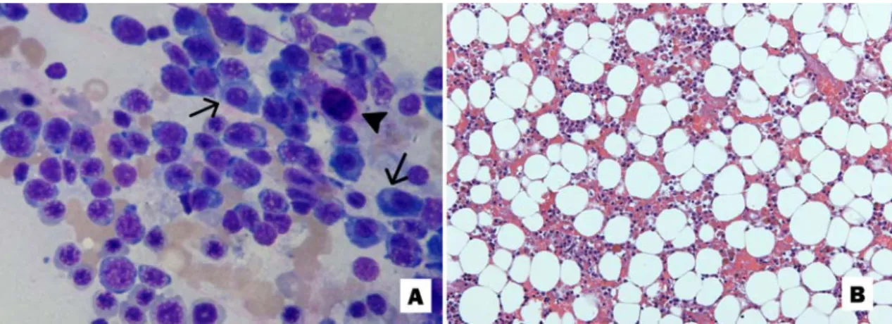 Figure 1.  Bone  marrow of  a  dog with  a Sertoli  cell  tumor.  A,  Erythroid  cells  dominate  the  field with  scattered plasma cells (arrow) and mast cells (arrow head)