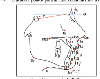 FIGURA 7 -   Traçado e pontos para análise cefalométrica tecido duro e mole.  