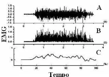 Figura 2.4.  Etapas do tratamento do sinal eletromiográfico para a elaboração dos envoltórios lineares